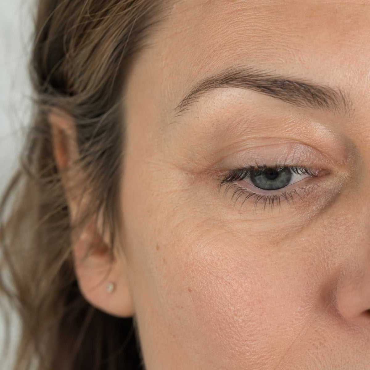 Close-up of the under-eye area showing the appearance of dark circles — Opuola