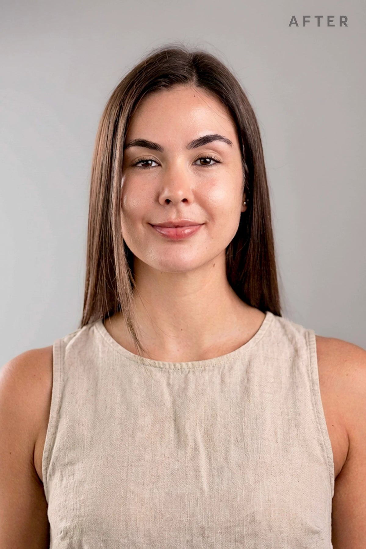 After 30 days of Aloha Blue Patches – 32-year-old woman with visibly reduced under-eye dark circles and smoother eye area.